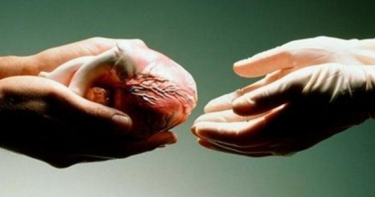 حكم التبرع بالاعضاء بعد الموت ابن باز 2 حكم التبرع بالاعضاء بعد الموت ابن باز