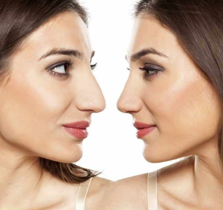 حكم تجميل الأنف للضرر النفسي ابن باز