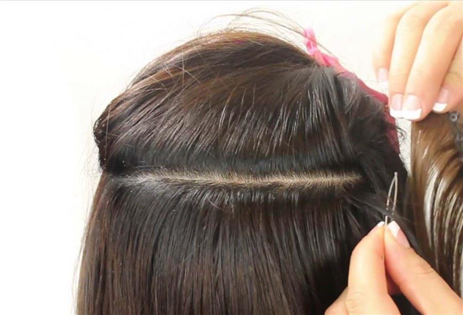 ما حكم زراعة الشعر