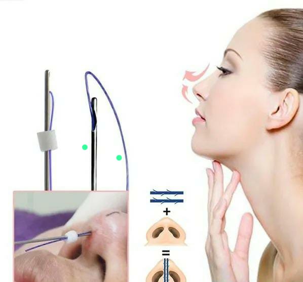 ركم تكلفة تجميل الأنف بالخيوط في دبي