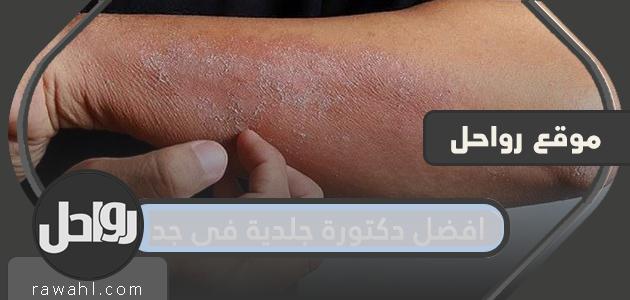 افضل دكتور جلدية في جدة 2024