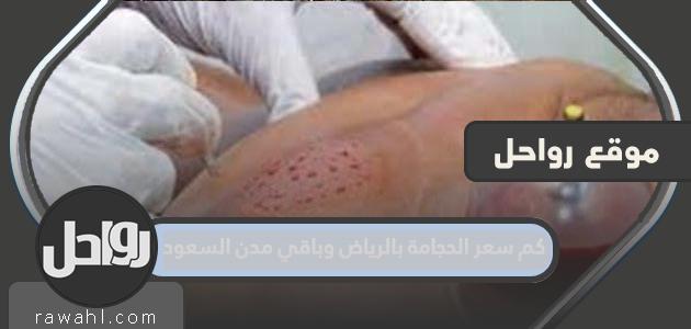 كم تكلفة الحجامة في الرياض ومدن أخرى في المملكة العربية السعودية؟
